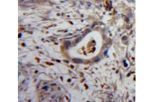 IHC-P analysis of Pancreas tissue, with DAB staining. (CXCL11 antibody  (AA 22-94))
