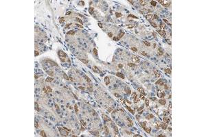 Immunohistochemical staining (Formalin-fixed paraffin-embedded sections) of human stomach using TAOK3 polyclonal antibody  shows strong cytoplasmic positivity in parietal cells. (TAO Kinase 3 antibody  (AA 323-432))