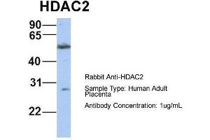 Host:  Rabbit  Target Name:  HDAC2  Sample Type:  Human Adult Placenta  Antibody Dilution:  1.