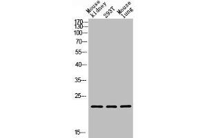 Western blot analysis of Mouse kidney, 293T, Mouse lung, antibody was diluted at 1000. (GREM2 antibody  (AA 71-120))