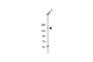 Anti-ADNP Antibody (C-term) at 1:1000 dilution + MCF-7 whole cell lysate Lysates/proteins at 20 μg per lane.
