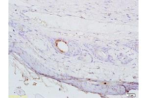 Formalin-fixed and paraffin embedded mouse cancer tissue labeled with Anti-AGPAT4 Polyclonal Antibody, Unconjugated  at 1:200 followed by conjugation to the secondary antibody, (SP-0023), and DAB staining (AGPAT4 antibody  (AA 231-330))