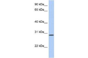 HAVCR2 antibody used at 1 ug/ml to detect target protein. (TIM3 antibody  (N-Term))