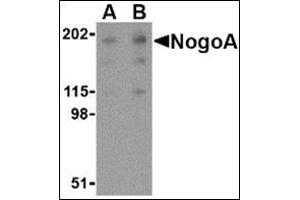 Western blot analysis of NogoA in human brain tissue lysate with this product at (A) 0. (Reticulon 4 antibody  (Isoform 1))