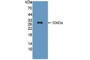 Detection of Recombinant LAG3, Rat using Polyclonal Antibody to Lymphocyte Activation Gene 3 (LAG3) (LAG3 antibody  (AA 209-451))
