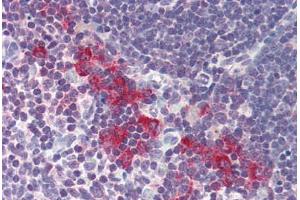 Human Thymus (formalin-fixed, paraffin-embedded) stained with DNASE2 antibody ABIN214485 at 5 ug/ml followed by biotinylated goat anti-rabbit IgG secondary antibody ABIN481713, alkaline phosphatase-streptavidin and chromogen. (DNASE2 antibody  (AA 347-360))