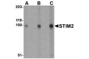 Image no. 1 for anti-Stromal Interaction Molecule 2 (Stim2) (Middle Region) antibody (ABIN318882) (Stim2 antibody  (Middle Region))