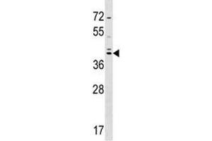 SOX7 antibody western blot analysis in HepG2 lysate. (SOX7 antibody  (AA 310-339))