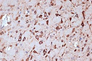 Immunohistochemistry of paraffin-embedded rat brain using PRKRA/PACTRabbit mAb (ABIN7269666) at dilution of 1:100 (40x lens).