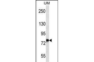 DNAJC14 Antibody (Center) (ABIN657070 and ABIN2846233) western blot analysis in uterus tumor cell line lysates (35 μg/lane). (DNAJC14 antibody  (AA 184-213))