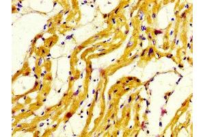 IHC image of ABIN7160588 diluted at 1:800 and staining in paraffin-embedded human heart tissue performed on a Leica BondTM system. (MYH7 antibody  (AA 1802-1915))