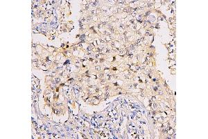 IHC analysis of BRG1 using anti-BRG1 antibody (ABIN7602029).