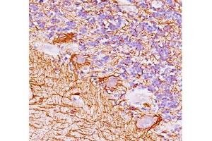 Human cerebellum stained with Neurofilament antibody (NF421). (Neurofilament antibody)