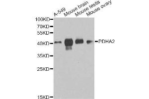 Western blot analysis of extracts of various cell lines, using PDHA2 antibody (ABIN6003651) at 1/1000 dilution.