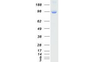 Western Blotting (WB) image for Protein Kinase D2 (PKD2) (Transcript Variant 1) protein (Myc-DYKDDDDK Tag) (ABIN2729640)