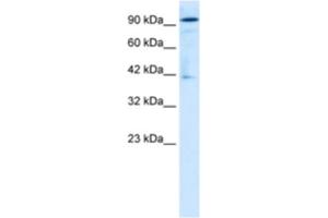 Western Blotting (WB) image for anti-OTU Domain Containing 7B (OTUD7B) antibody (ABIN2460998) (OTUD7B antibody)