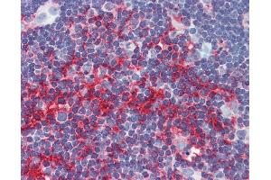 Anti-Beta Actin antibody IHC of human thymus.