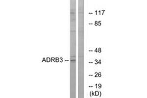 Western Blotting (WB) image for anti-Adrenergic, beta-3-, Receptor (ADRB3) (AA 250-299) antibody (ABIN2890752) (ADRB3 antibody  (AA 250-299))