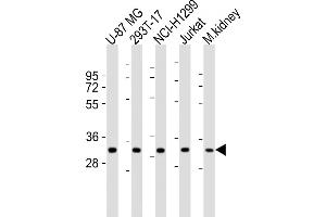 All lanes : Anti-FN3KRP Antibody (N-Term) at 1:1000-1:2000 dilution Lane 1: U-87 MG whole cell lysates Lane 2: 293T-17 whole cell lysates Lane 3: NCI- whole cell lysates Lane 4: Jurkat whole cell lysates Lane 5: mouse kidney lysates Lysates/proteins at 20 μg per lane. (FN3KRP antibody  (AA 24-58))
