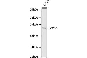 Western blot analysis of extracts of A-549 cells, using CD55 antibody (ABIN6130080, ABIN6138206, ABIN6138207 and ABIN6218089) at 1:1000 dilution. (CD55 antibody  (AA 40-300))