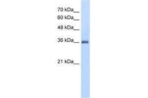 Western Blotting (WB) image for anti-Phosphatidic Acid Phosphatase Type 2A (PPAP2A) antibody (ABIN2462626) (PPAP2A antibody)