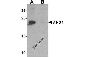Western Blotting (WB) image for anti-Zinc Finger, FYVE Domain Containing 21 (ZFYVE21) (N-Term) antibody (ABIN1031675) (ZFYVE21 antibody  (N-Term))