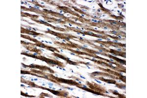 Anti-AIF antibody, IHC(P) IHC(P): Rat Cardiac Muscle Tissue (AIF antibody  (C-Term))