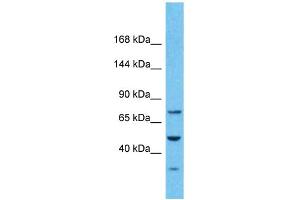Host:  Rabbit  Target Name:  PKD2  Sample Type:  Stomach Tumor lysates  Antibody Dilution:  1. (PKD2 antibody  (N-Term))