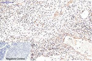 Immunohistochemical analysis of paraffin-embedded human appendix tissue. (NF-kB p65 antibody)
