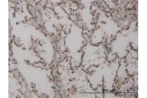 Immunoperoxidase of monoclonal antibody to FOXL1 on formalin-fixed paraffin-embedded human lung. (FOXL1 antibody  (AA 132-240))