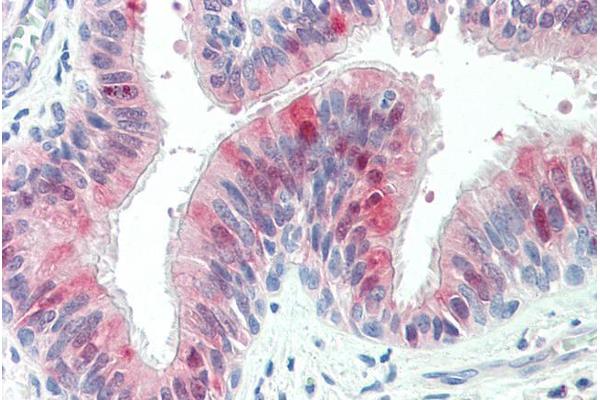 ZDHHC13 antibody  (C-Term)