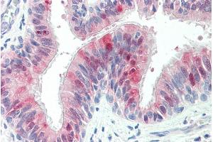 ABIN335141 (5µg/ml) staining of paraffin embedded Human Lung.