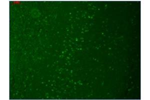 Immunofluorescence (IF) image for anti-Transient Receptor Potential Cation Channel, Subfamily M, Member 7 (TRPM7) (AA 1817-1863), (C-Term) antibody (ABIN452417) (TRPM7 antibody  (C-Term))