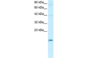 WB Suggested Anti-APOBEC3G Antibody Titration:  0. (APOBEC3G antibody  (N-Term))