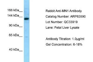 Western Blotting (WB) image for anti-MN1 proto-oncogene (MN1) (C-Term) antibody (ABIN2789559)