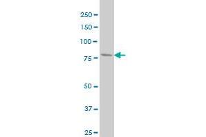 PFKL monoclonal antibody (M03), clone 2A9 Western Blot analysis of PFKL expression in HeLa . (PFKL antibody  (AA 441-540))