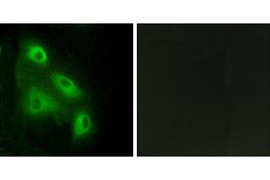 Peptide - +Immunohistochemistry analysis of paraffin-embedded human colon carcinoma tissue, using ES8L3 antibody. (EPS8-Like 3 antibody)