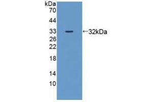 Western blot analysis of recombinant Mouse ZRF1.