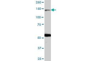 ARHGAP20 MaxPab polyclonal antibody. (ARHGAP20 antibody  (AA 1-1191))