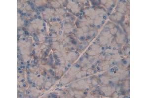 Used in DAB staining on fromalin fixed paraffin- embedded Kidney tissue (GRPR antibody  (AA 1-114))