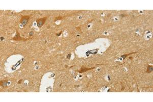 Immunohistochemistry of paraffin-embedded Human brain using KLC1 Polyclonal Antibody at dilution of 1:40 (KLC1 antibody)