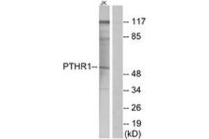 Western blot analysis of extracts from Jurkat cells, using PTHR1 Antibody. (PTH1R antibody  (AA 145-194))