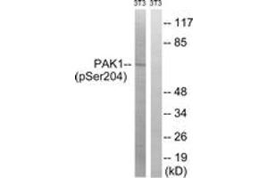 Western blot analysis of extracts from NIH-3T3 cells treated with UV 15', using PAK1 (Phospho-Ser204) Antibody. (PAK1 antibody  (pSer204))
