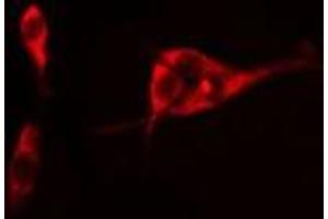 ABIN6275045 staining Hela cells by IF/ICC. (ATG4C antibody  (N-Term))