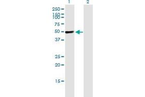 Western Blot analysis of PIK3R1 expression in transfected 293T cell line by PIK3R1 monoclonal antibody (M02), clone 1C10. (PIK3R1 antibody  (AA 1-454))