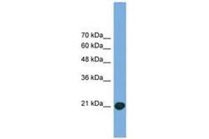 Image no. 1 for anti-COMM Domain Containing 8 (COMMD8) (C-Term) antibody (ABIN6746485) (COMMD8 antibody  (C-Term))