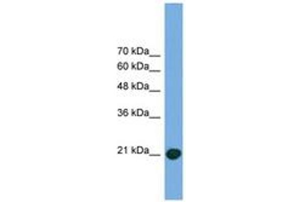 COMMD8 antibody  (C-Term)