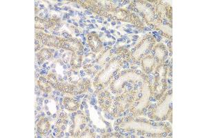Immunohistochemistry of paraffin-embedded rat kidney using AUH antibody at dilution of 1:100 (x400 lens). (AUH antibody)
