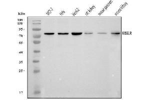 Western blot analysis of GPR54/KISS1R using anti-GPR54/KISS1R antibody (ABIN7602153). (KISS1R antibody  (AA 60-373))