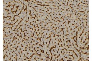 ABIN6277613 at 1/100 staining Mouse liver tissue by IHC-P. (SULT2A1 antibody  (C-Term))
